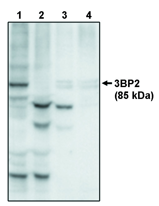"Western blot analysis
using anti-3BP2 at 10
µg/ml on recombinant full
lenth 3BP2 protein (1),
3BP2 protein minus the
PH domain (2), 3BP2
protein minus the PR
domain (3) and 3BP2
protein minus the SH2
domain (4)."